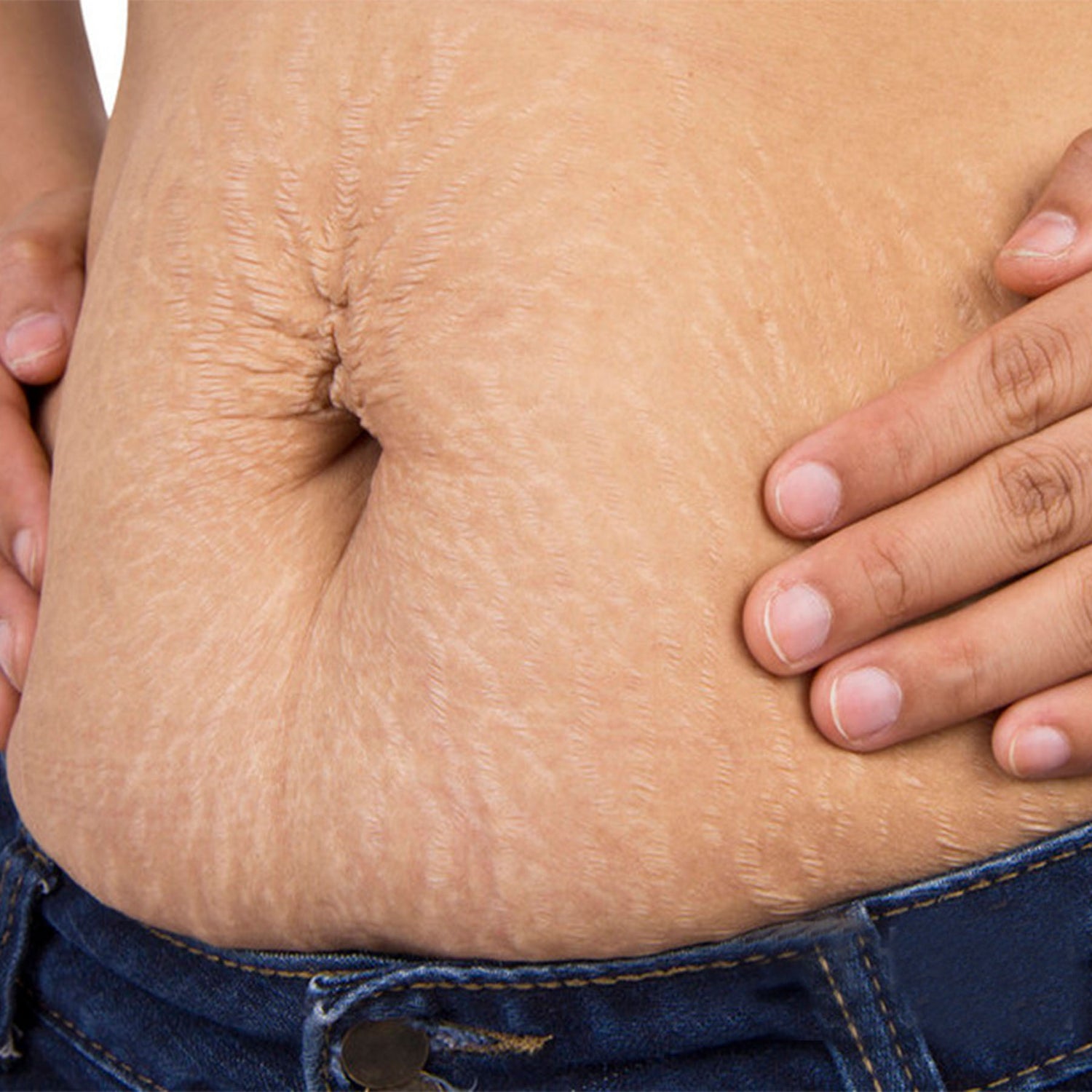 Accelerate Postpartum Recovery with Red Light Therapy