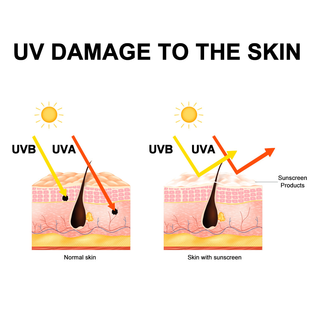 Red Light Therapy Side Effects: A Quick Guide – Bontanny