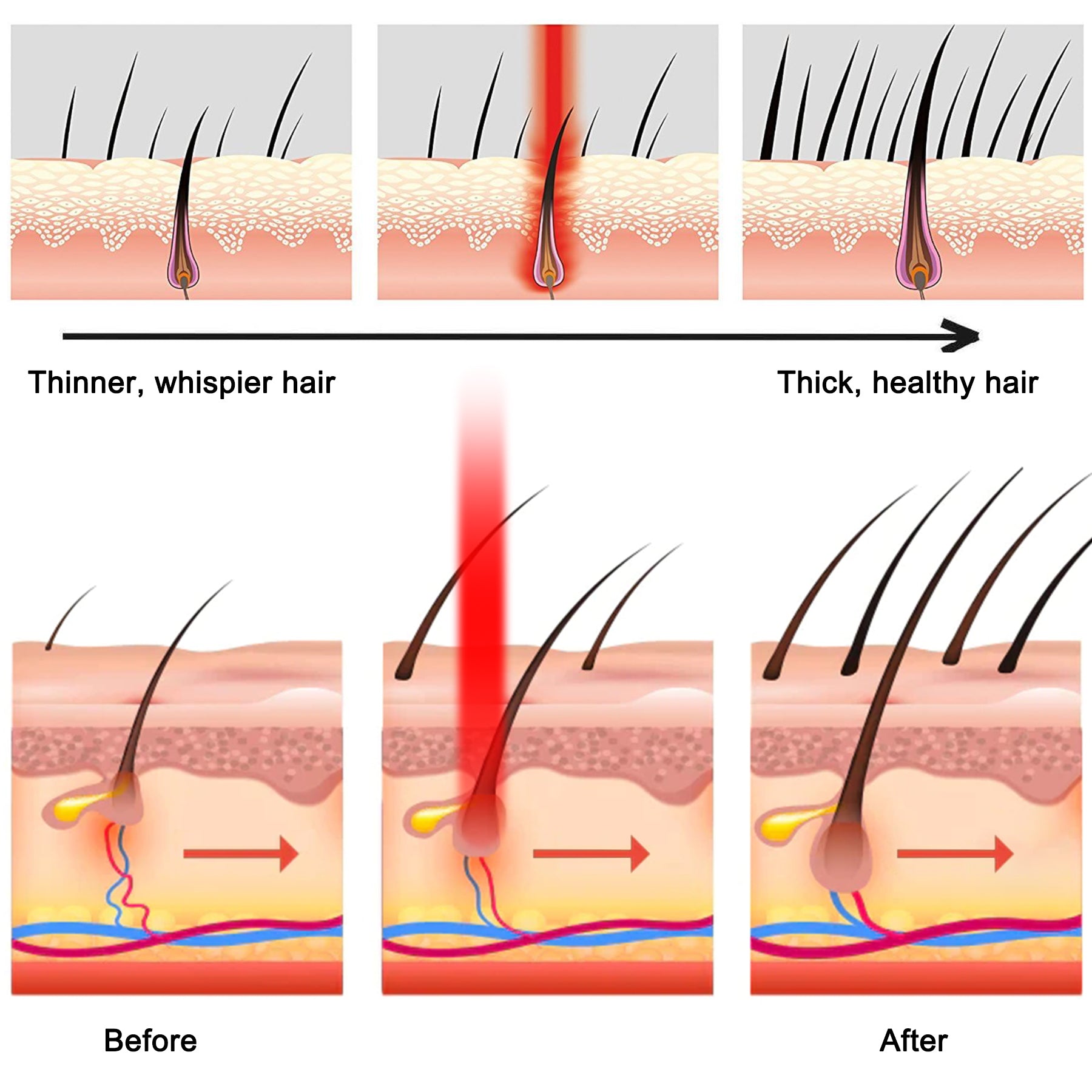 What Is Red Light Therapy for Hair Loss?