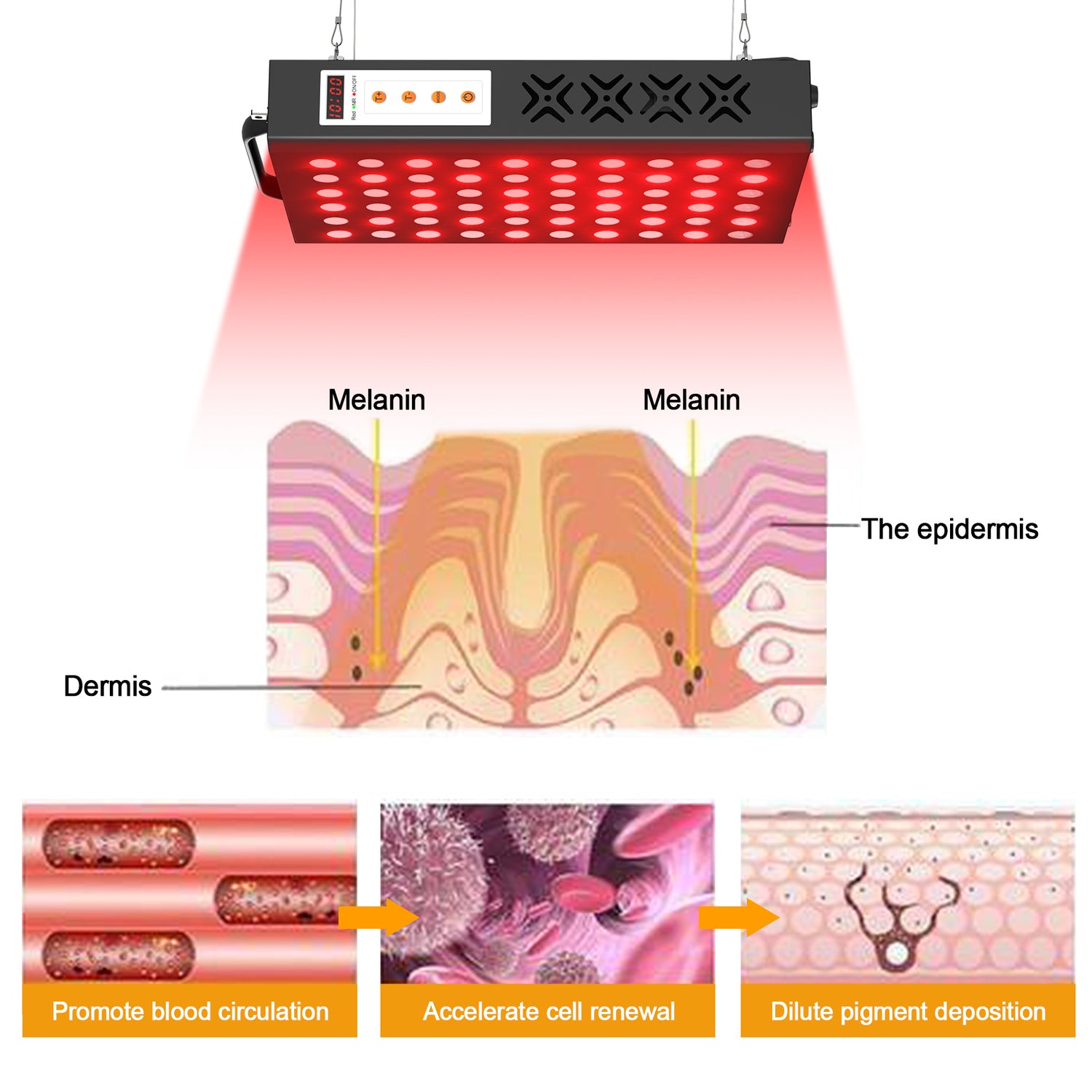 Does Red Light Therapy Help Acne?